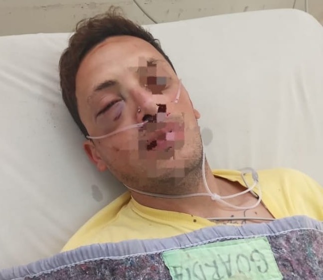 Eric Gabriel López evoluciona favorable y pasó de terapia a una sala común